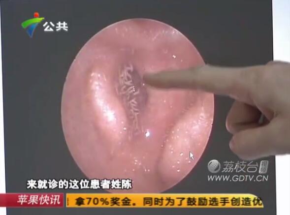 �@�������Ӷ����L�M��ɫ���x��˺ҧ����ʹ��������