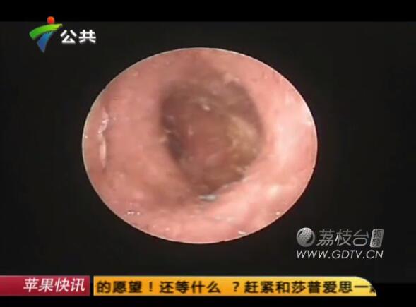 �@�������Ӷ����L�M��ɫ���x��˺ҧ����ʹ��������