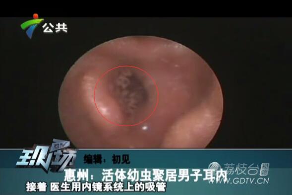 �@�������Ӷ����L�M��ɫ���x��˺ҧ����ʹ��������