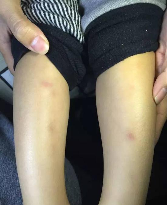 ���һ�׃��@���ء������ͯ�� ���ӛ]���r˯�X